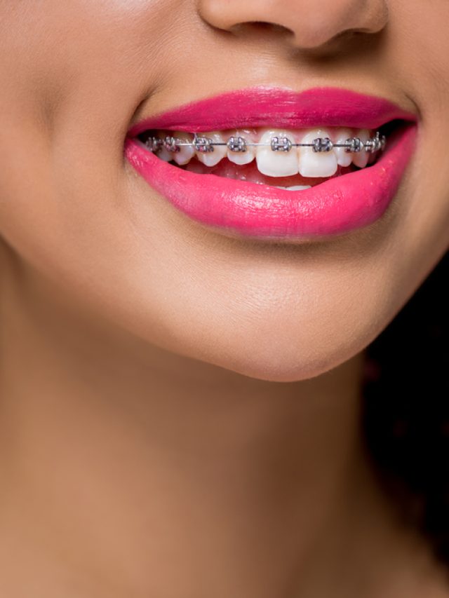 Transform Your Smile with Orthodontics