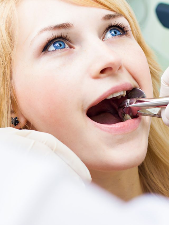 Simple Tooth Extraction
