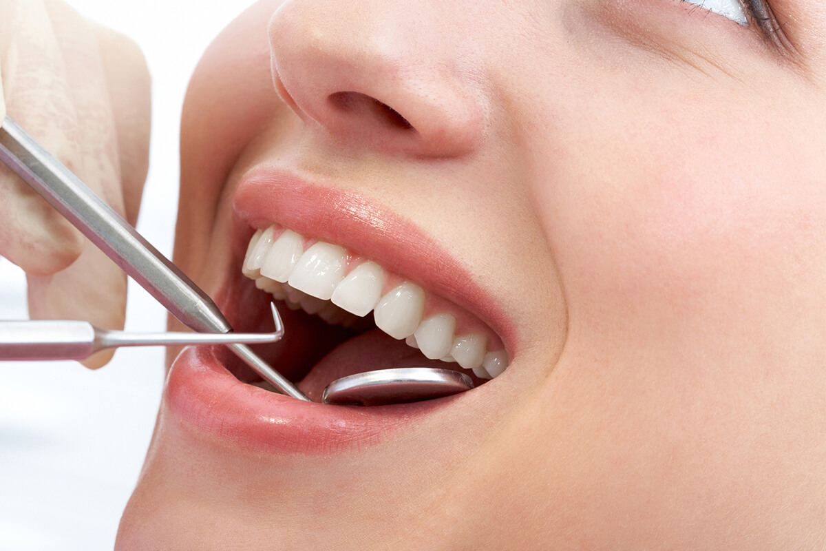 Teeth Cleaning Dentist in West Hills CA Area