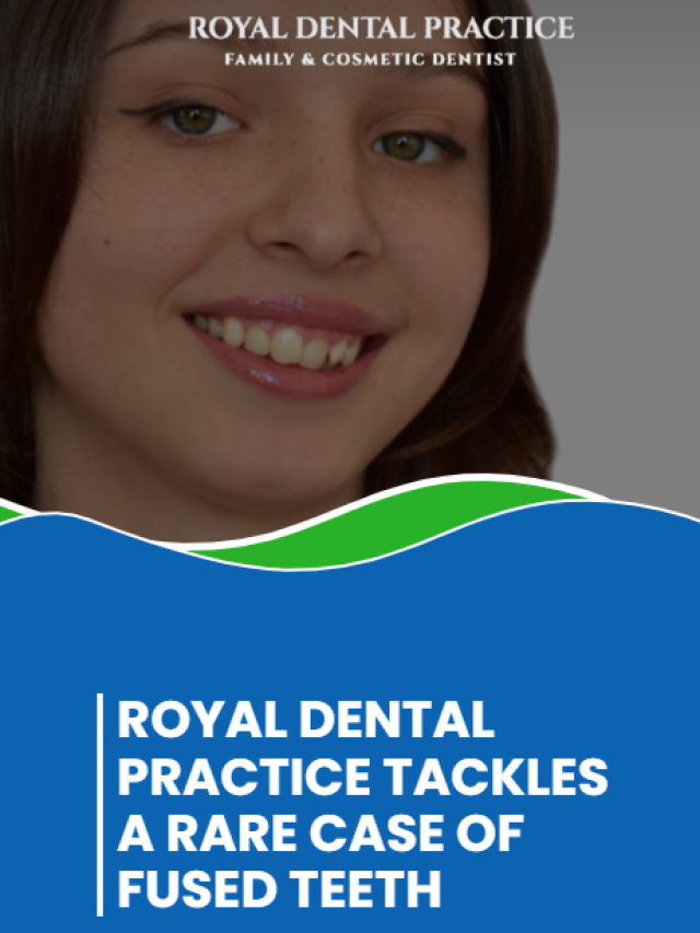 Royal Dental Practice tackles a rare case of fused teeth