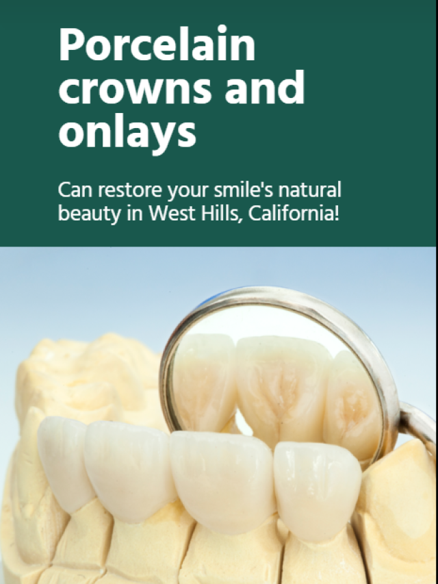 Porcelain Crowns and Onlays